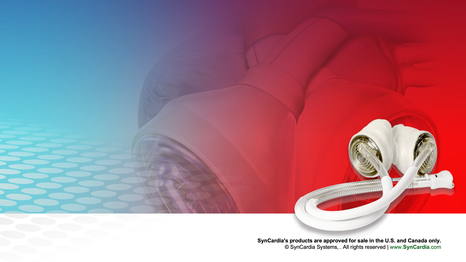 The SynCardia Total Artificial Heart and its driveline.